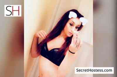 Kim 23Yrs Old Escort Toronto Image - 0