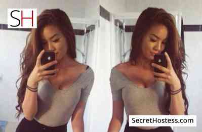 Apple 22Yrs Old Escort Riyadh Image - 2