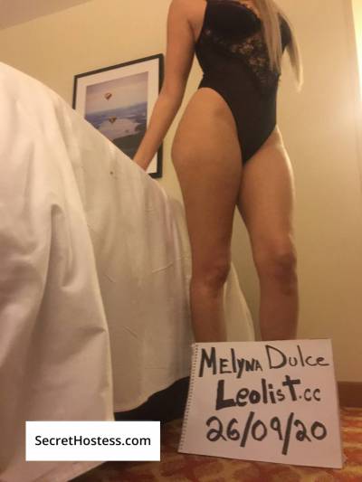 22 year old Hispanic Escort in Ottawa New in town /\ Incall in Downtown /\ Available Now