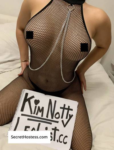 Kim Notty 24Yrs Old Escort Ottawa Image - 5