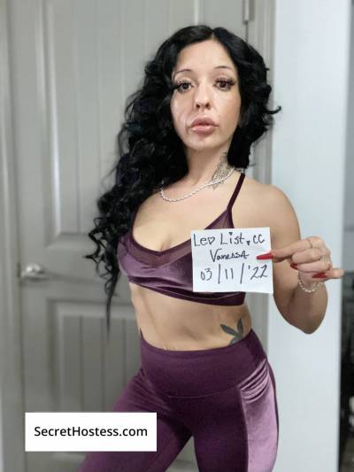 32 year old Asian Escort in Edmonton The sweetest treat , let’s warm up together tonight xo