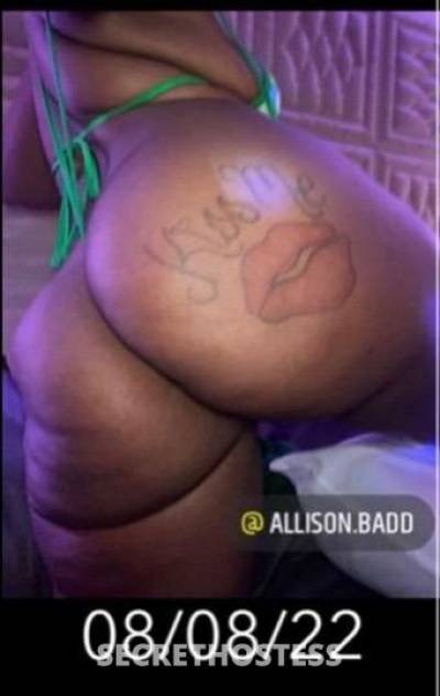 22Yrs Old Escort Chicago IL Image - 3