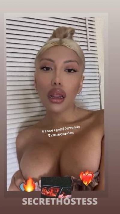 21Yrs Old Escort Bronx NY Image - 2
