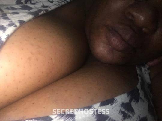 26Yrs Old Escort North Bay CA Image - 0