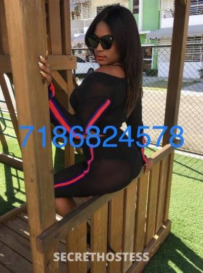 25Yrs Old Escort Bronx NY Image - 1