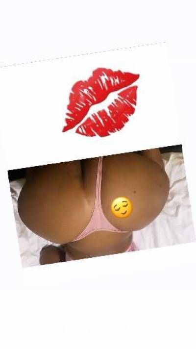 33Yrs Old Escort Bronx NY Image - 1