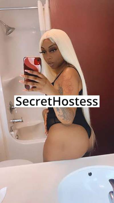 Treasure 21Yrs Old Escort Los Angeles CA Image - 0