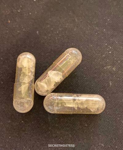 Emile 26Yrs Old Escort St Catharines Image - 8