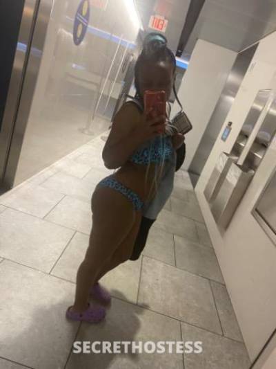 26Yrs Old Escort Bronx NY Image - 1