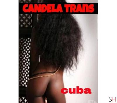 New 🔥trans candela 🔥DOMINATRIX🔥 hot party sexy 24h in Glasgow