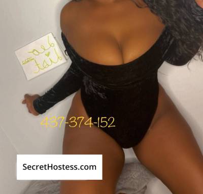 Kendra Doll 26Yrs Old Escort 75KG 170CM Tall Scarborough Image - 12