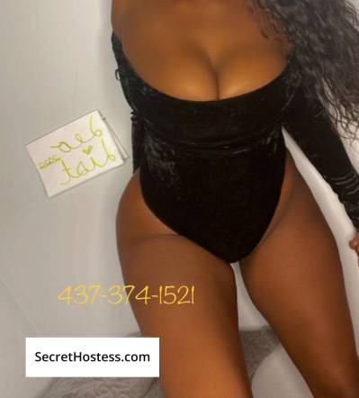 Kendra Doll 26Yrs Old Escort 75KG 170CM Tall Scarborough Image - 13