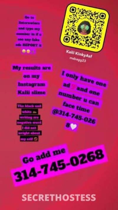 Kinkykalii 23Yrs Old Escort Saint Louis MO Image - 6
