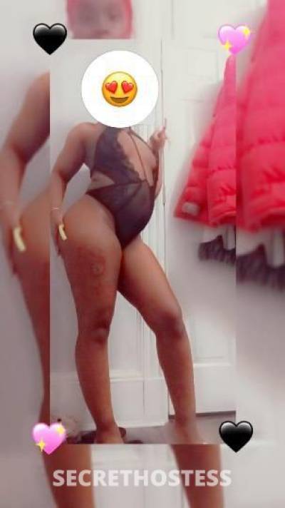 26Yrs Old Escort Westchester NY Image - 2