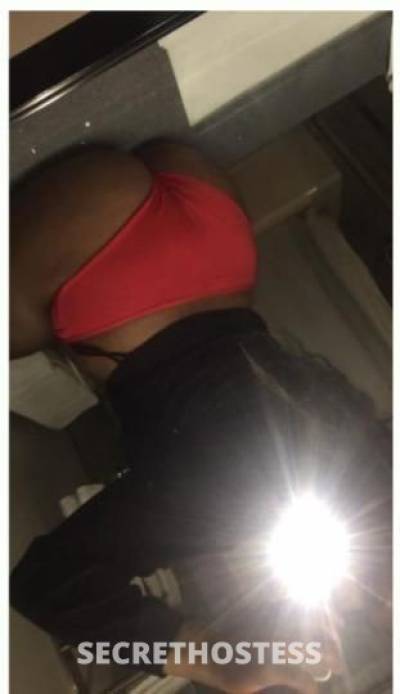 SKYE 26Yrs Old Escort Oshawa Image - 1