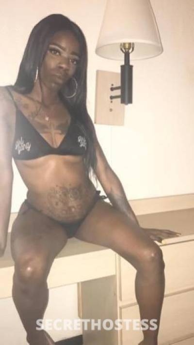 Star 26Yrs Old Escort Dallas TX Image - 1