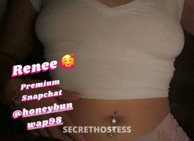 Renee? 25Yrs Old Escort Buffalo NY Image - 3
