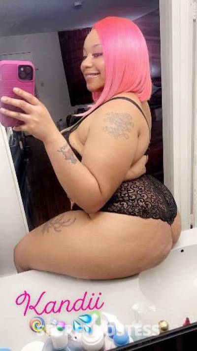 Kandii🍭🍬 26Yrs Old Escort Meridian MS Image - 1