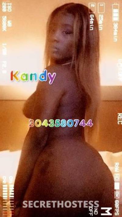 Kandy 27Yrs Old Escort Central Jersey NJ Image - 2