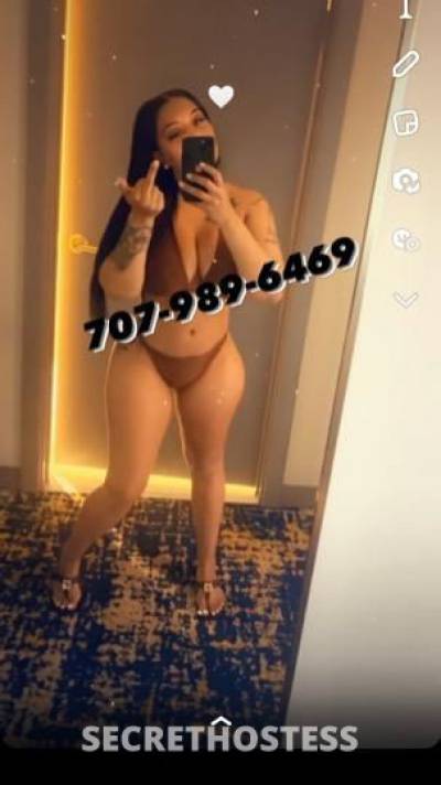 ExoticZoey 27Yrs Old Escort Oakland CA Image - 6