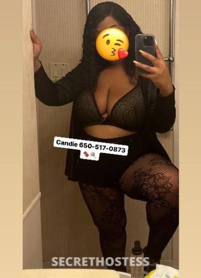 Candie 25Yrs Old Escort San Francisco CA Image - 2