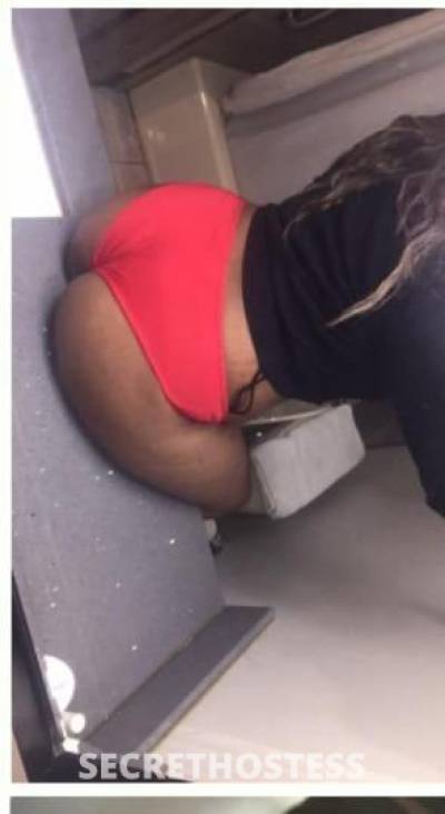 SKYE 26Yrs Old Escort Oshawa Image - 6