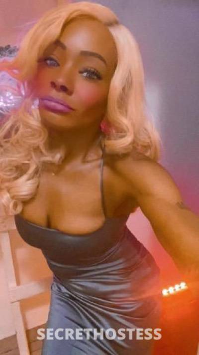 A.Lexx 32Yrs Old Escort Westchester NY Image - 0