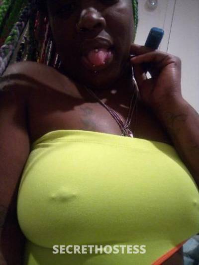 star 25Yrs Old Escort Westchester NY Image - 8