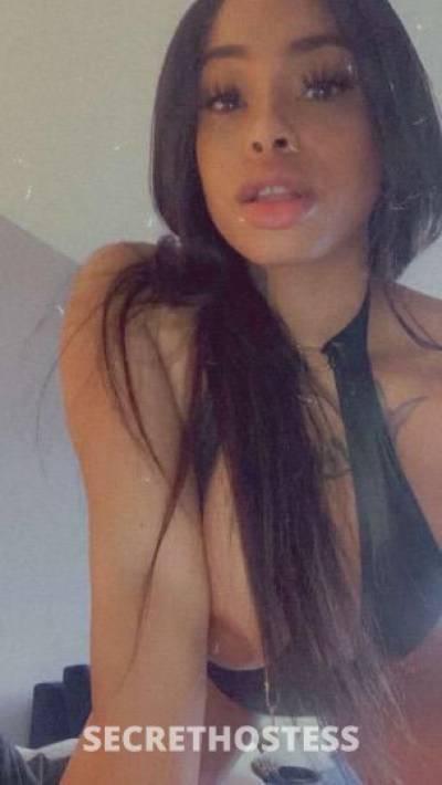 Freckle face beauty available now in Mobile AL