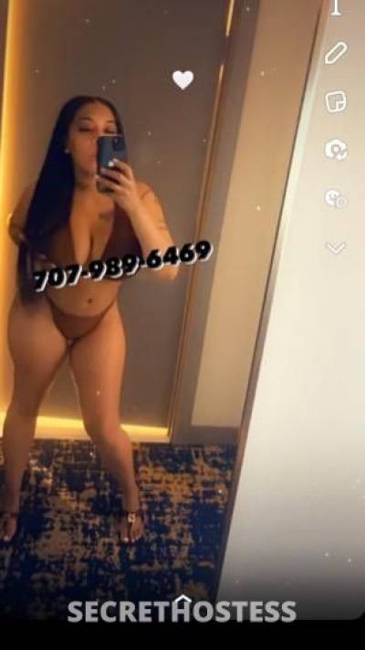 ExoticZoey 27Yrs Old Escort Oakland CA Image - 2