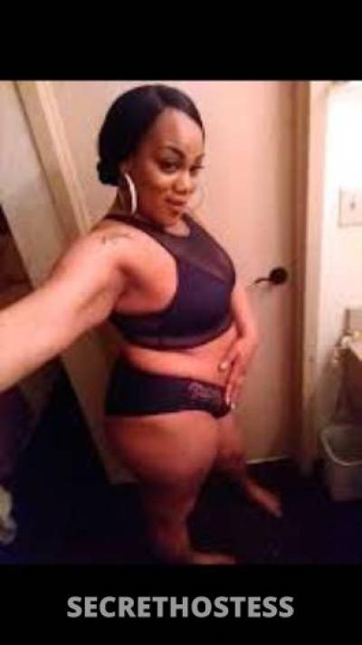 TropicanaPineapple 31Yrs Old Escort Oakland CA Image - 6