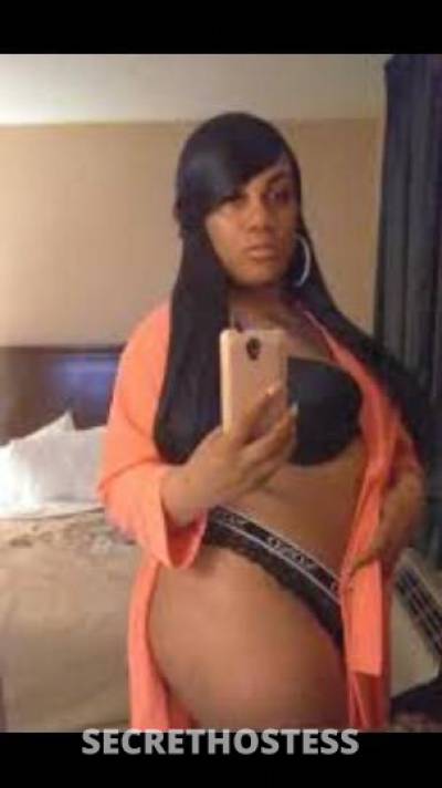 TropicanaPineapple 31Yrs Old Escort Oakland CA Image - 0
