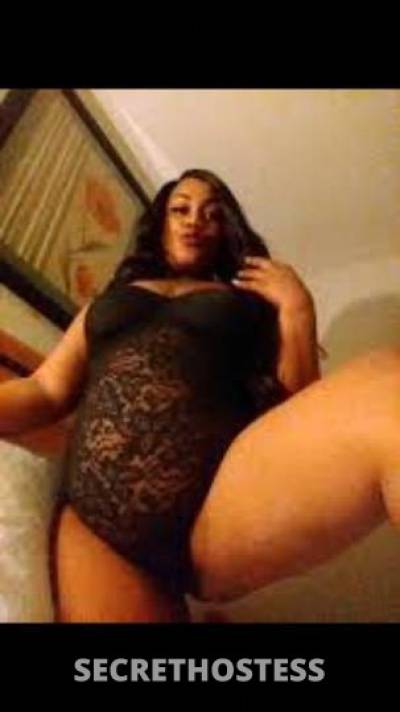 TropicanaPineapple 31Yrs Old Escort Oakland CA Image - 2