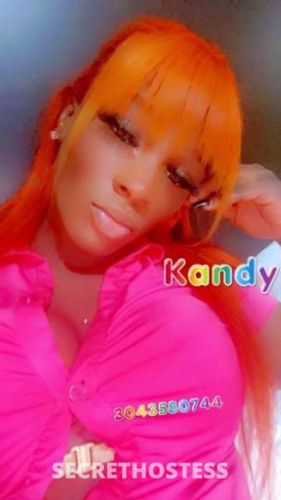 Kandy 28Yrs Old Escort Central Jersey NJ Image - 1