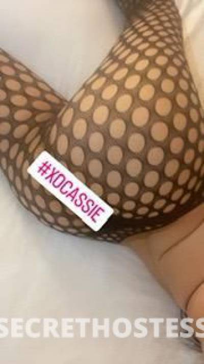 CASSIE 22Yrs Old Escort North Bay CA Image - 6