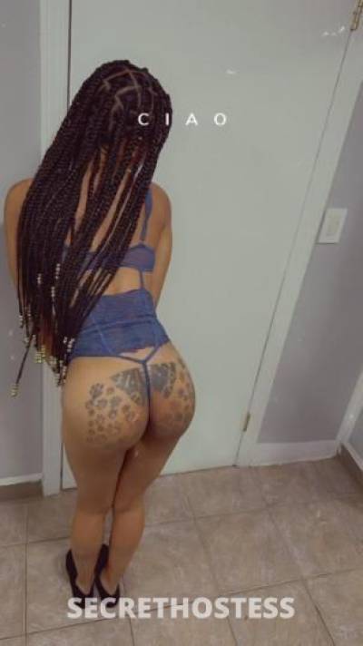 22Yrs Old Escort Westchester NY Image - 0