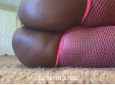 Sweets 24Yrs Old Escort Bronx NY Image - 2