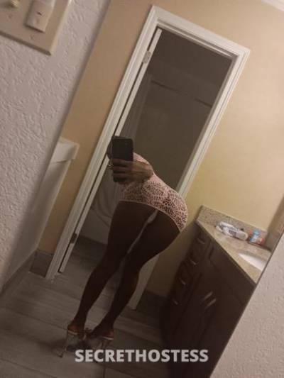 Kimm 24Yrs Old Escort Los Angeles CA Image - 1