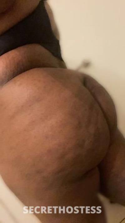 23Yrs Old Escort Dallas TX Image - 0