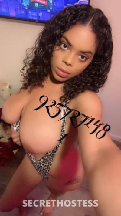 24Yrs Old Escort Oakland CA Image - 6