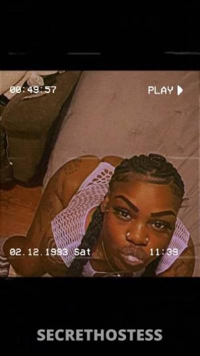 Lips😘 26Yrs Old Escort Chicago IL Image - 9