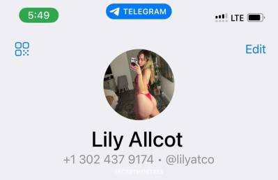 Lily 26Yrs Old Escort Size 7 157CM Tall Fairbanks AK Image - 3
