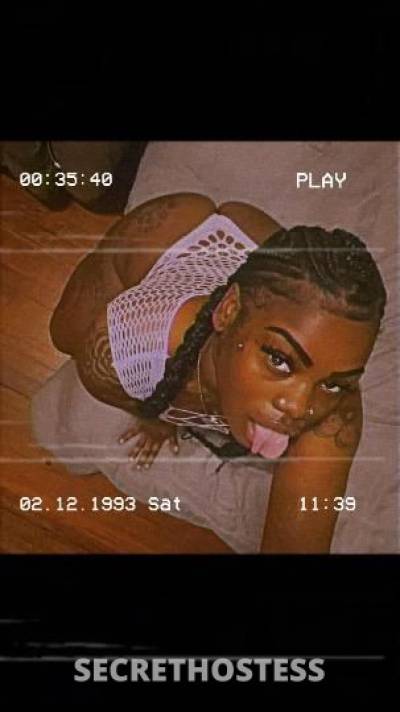 Lips👄 26Yrs Old Escort Chicago IL Image - 7