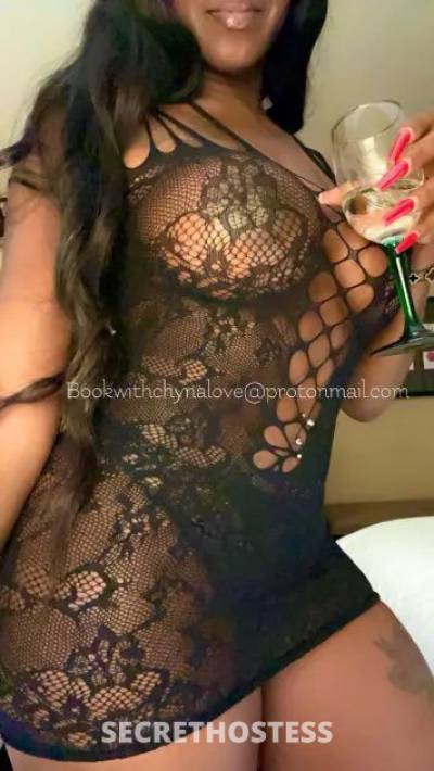 28Yrs Old Escort Atlanta GA Image - 1