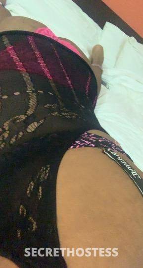 None 26Yrs Old Escort Concord CA Image - 3
