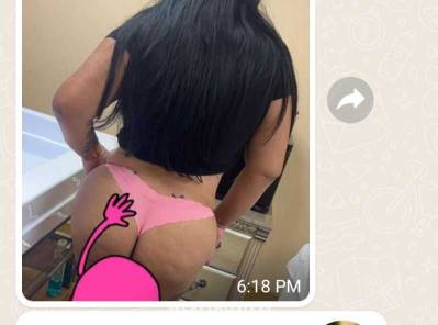 30Yrs Old Escort Bronx NY Image - 2