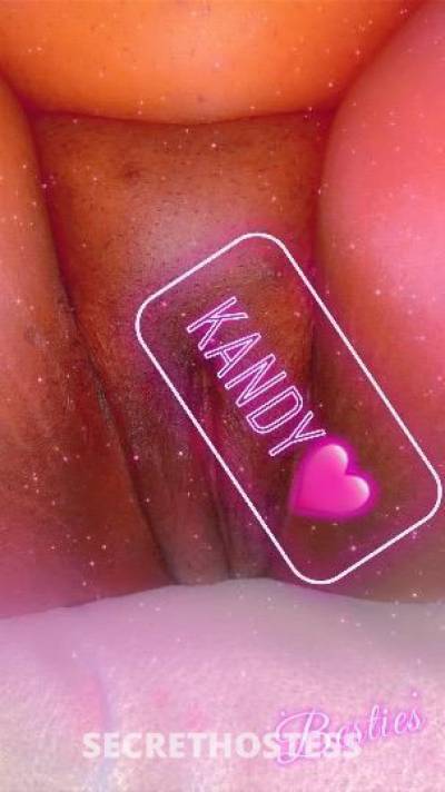 Kandy&Kaution 21Yrs Old Escort South Jersey NJ Image - 0