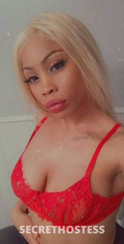 Lotusbaby 22Yrs Old Escort San Jose CA Image - 1