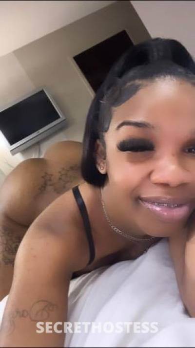 BraceFace 23Yrs Old Escort Atlanta GA Image - 2