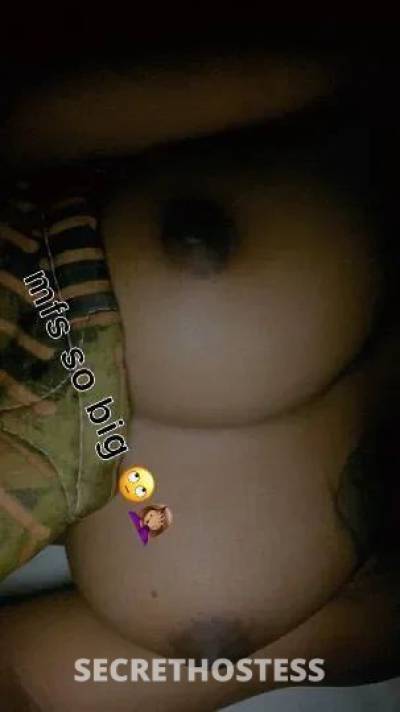 22 year old Escort in North Mississippi MS xxxx-xxx-xxx Outcalls Available, Greenville Ms Area Only! 